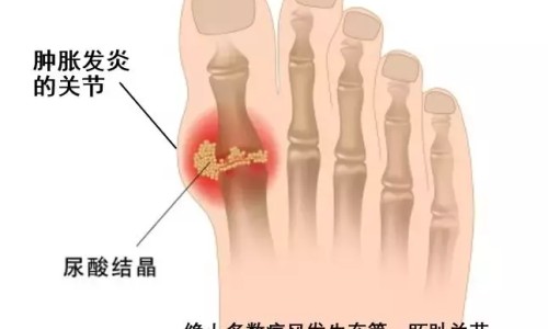关节痛烤电越烤越疼-关节炎烤电烤出汗网 :分享关节炎烤电一般多长时间-烤电对关节炎有效果吗知识